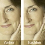 Collagen Booster Protein – Was ist das?