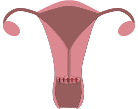 Muttermundmerkmale