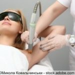 Laser Behandlung zur Entfernung der Körperhaare